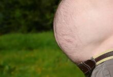 Übergewicht und Krebsrisiko: Wie Bauchfett zur Tumorentstehung beiträgt